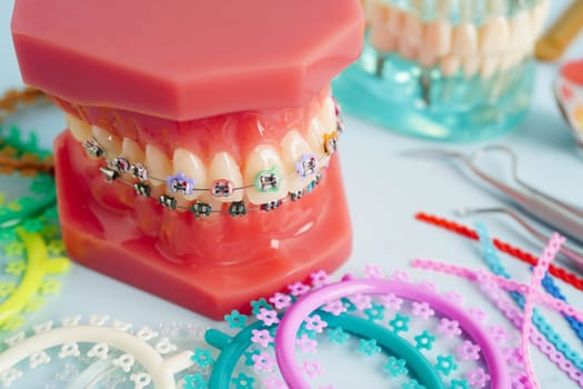 Orthodontic ligatures rings and ties, elastic rubber bands on orthodontic braces, model for dentist studying about dentistry.