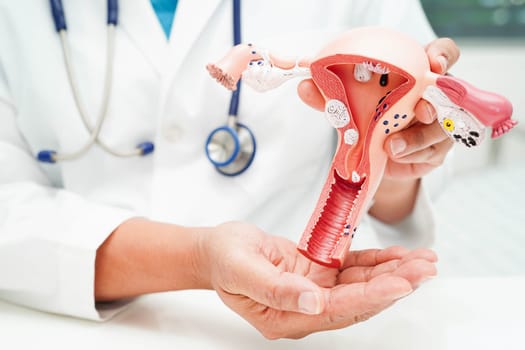 Uterus, doctor holding human anatomy model for study diagnosis and treatment in hospital.