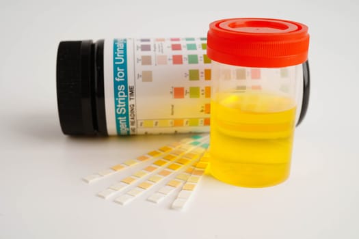 Urinalysis, urine cup with reagent strip pH paper test and comparison chart in laboratory.