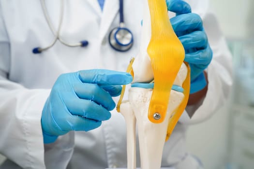 Knee osteoarthritis, Doctor showing model knee joint orthopedic.
