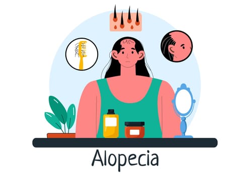 Alopecia Vector Illustration featuring Hair Loss due to Autoimmune Disease and Baldness in a Healthcare Theme with a Flat Style Cartoon Background