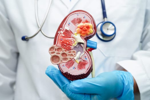 Chronic kidney disease, doctor with model for treatment urinary system, urology, Estimated glomerular filtration rate eGFR.