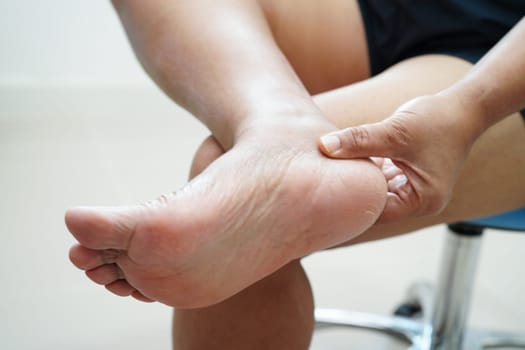 Asian woman care feet with crack and dry heel skin, treat and repair with moisturizing cream.