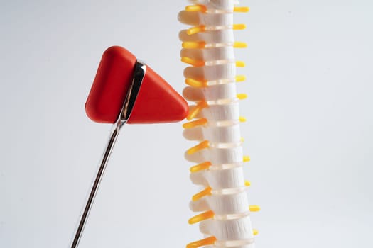 Spinal nerve and bone with knee reflex hammer, Lumbar spine displaced herniated disc fragment, Model for treatment medical in the orthopedic department.