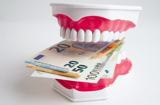Treatment dental care cost, dental expense or fee, Euro banknote money with teeth model.