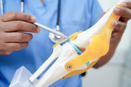 Knee osteoarthritis, Doctor showing model knee joint orthopedic.