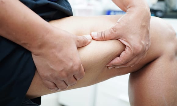 Asian woman with cellulite on leg skin fat, overweight problem.