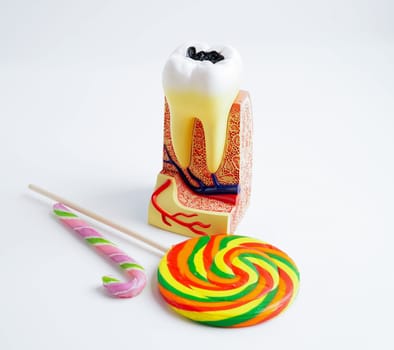 Tooth decay with sweet sugar candy, bad food for dental health care.