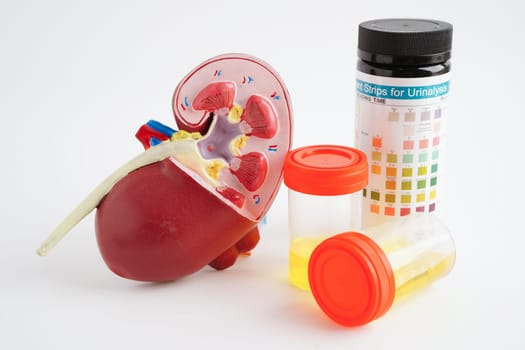 Urinalysis, Kidney and urine cup for check health examination in laboratory.