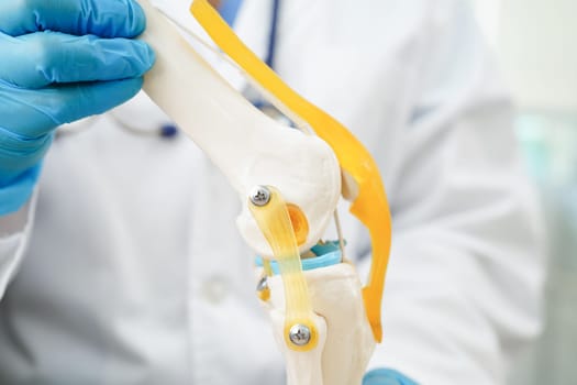Knee osteoarthritis, Doctor showing model knee joint orthopedic.