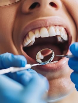 A close-up view of a dental examination, with a dental mirror being used to inspect the teeth and mouth of the patient. The image captures the intricate details of the dental procedure