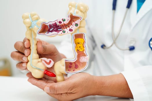 Intestine, doctor holding human anatomy model for study diagnosis and treatment in hospital.