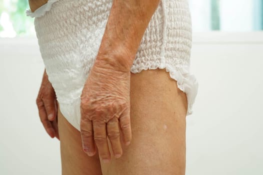 Asian senior woman patient wearing adult incontinence diaper pad in hospital.