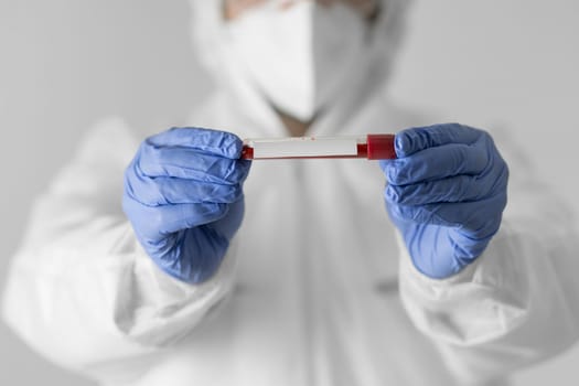 close up doctor holding blood sample (1)
