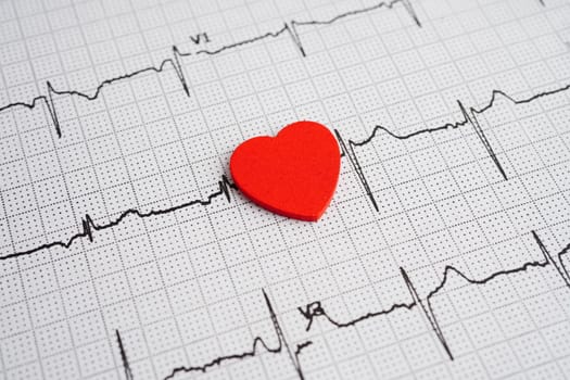 Electrocardiogram (ECG), heart wave, heart attack, cardiogram report.