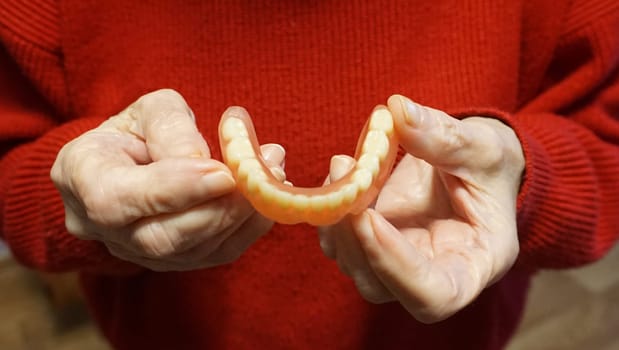 flexible nylon denture on senior female hands. Removable dentures flexible, devoid of nylon, hypoallergenic exempt from monomer