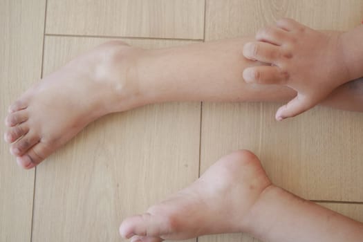 a kid suffering from itching skin on feet .