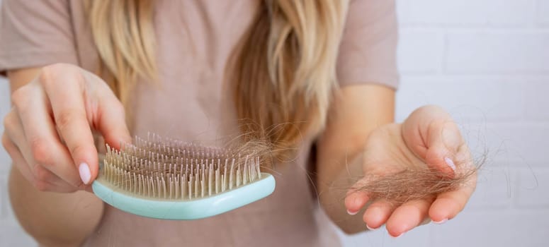 Woman's hair is falling out. hairbrush,hair loss.