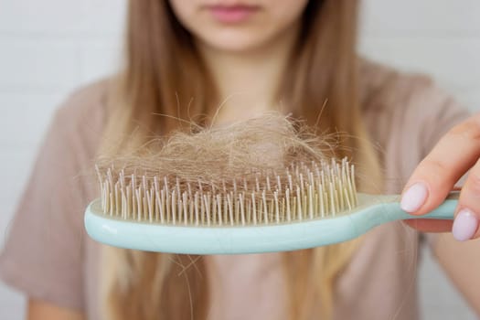 Woman's hair is falling out. hairbrush,hair loss.