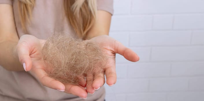 Woman's hair is falling out. hairbrush,hair loss.