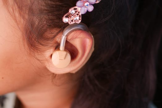 Hearing aid on a child's ear.