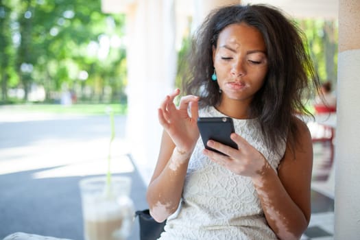 Woman with vitiligo skin disorder using smartphone while sitting at sidewalk cafe. Black young lady is text messaging through device during weekend on sunny day.