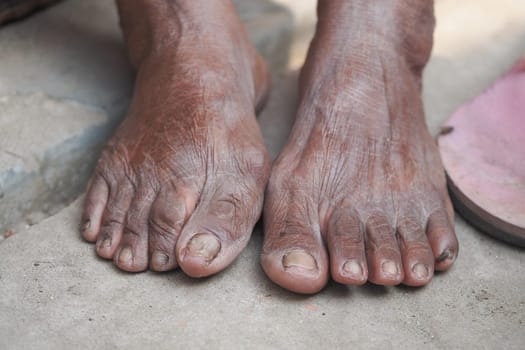 Close-up of weathered feet resting on a textured ground outdoors.