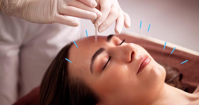 Young woman feels relaxed and beautiful after acupuncture treatment session. Possible professions: acupuncturist, spa therapist, alternative medicine practitioner.