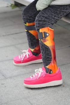 A child in bright shoes relaxes on a bench with leg braces.