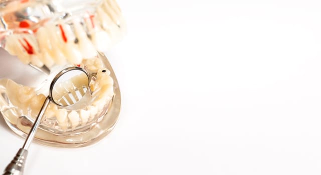 Mockup Dental Concept. Basic Dental Instruments Set, Mirror Anatomical Teeth Model. Copy Space. Oral Hygiene , Dental Care. Transparent Disease Tooth Model with Implant Bridge.Horizontal