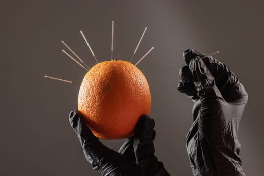 concept dry needling method. Acupuncture training concept. Black-gloved hands insert fine needles into an orange to practice needling techniques in alternative medicine.