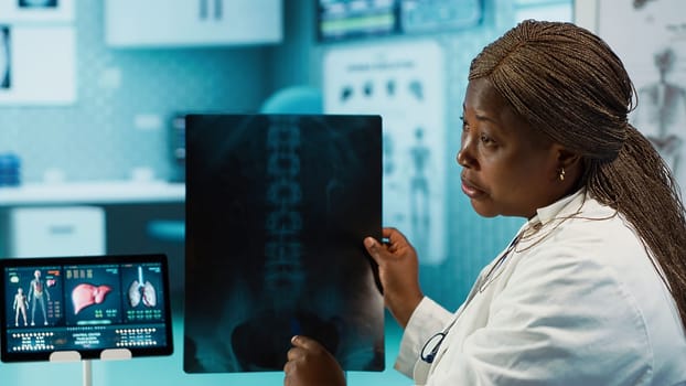 Medical professional explaining the x ray imaging for a diagnosis, doing scan interpretation during check up visit. African american female medic gives feedback to male client. Camera A.