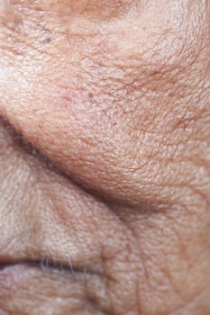 Detailed depiction of skin texture showing wrinkles and fine lines.