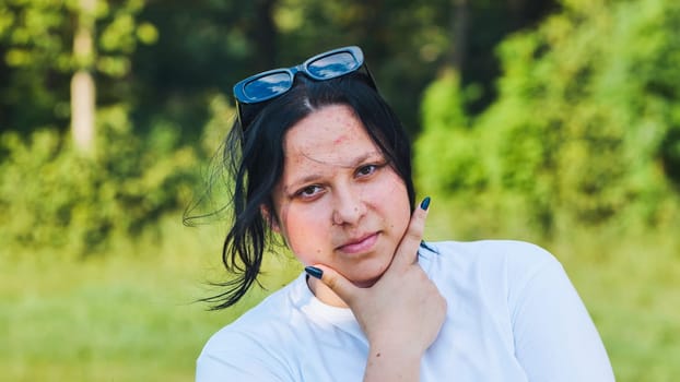 Young woman wearing sunglasses relaxes in the park on a sunny day, gently touching her chin with her hand