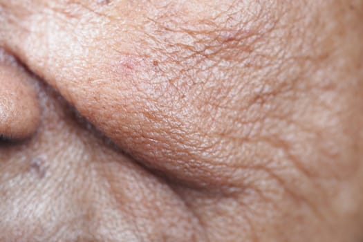 Detailed view showing wrinkles and texture of elderly skin on face