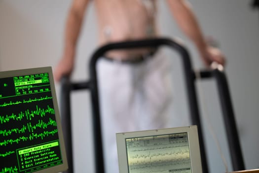 A middle-aged man is undergoing a medical stress test on a treadmill, connected to ECG electrodes for heart monitoring in a clinical environment.