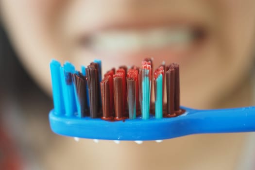 Close-up view of a blue toothbrush with blood .