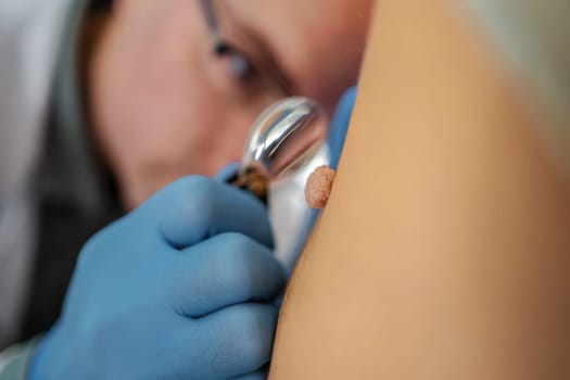 A healthcare professional examines a skin condition closely in a clinic.