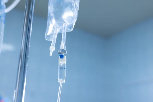 Close-up of IV infusion system with clear fluid bag in a hospital setting, used for patient hydration and treatment.