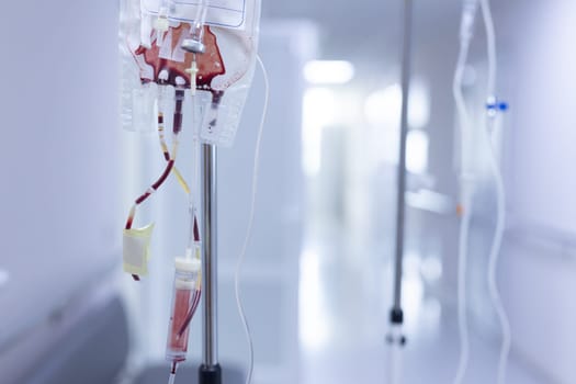 Close-up of blood transfusion bag and IV system in a hospital corridor, medical equipment for emergency care.