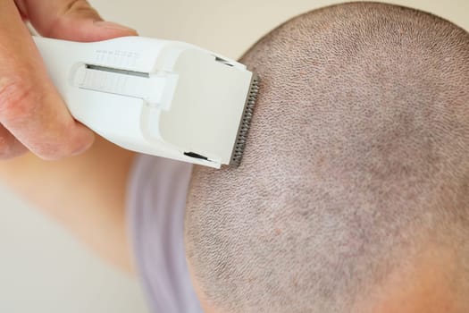 Close-up view of a person using an electric razor to shave their head, short buzz cut.