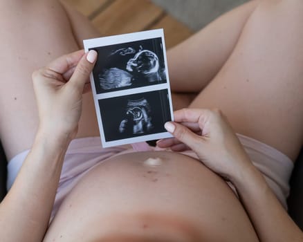 Pregnant woman holding baby ultrasound photo