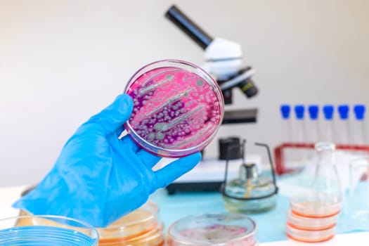 Examine bacteria in petri dishes in the laboratory. Selective focus. nature.