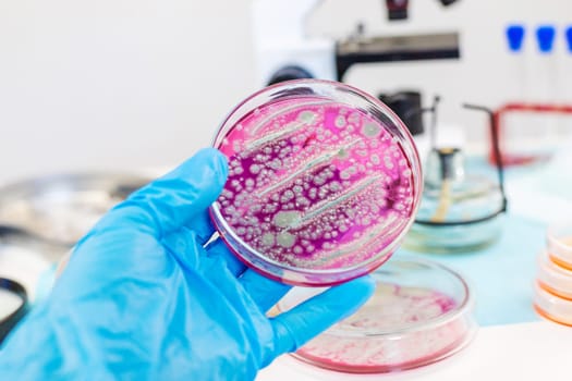 Examine bacteria in petri dishes in the laboratory. Selective focus. nature.
