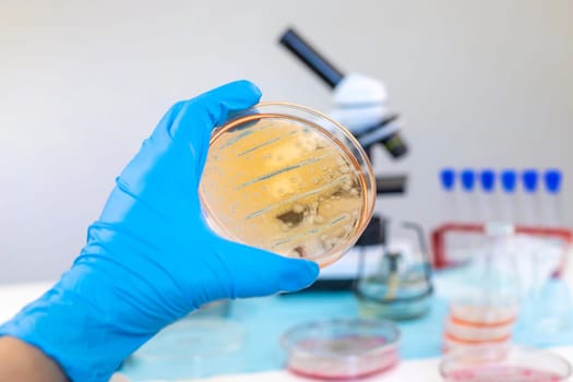 Examine bacteria in petri dishes in the laboratory. Selective focus. nature.