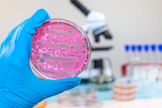 Examine bacteria in petri dishes in the laboratory. Selective focus. nature.