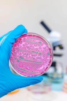 Examine bacteria in petri dishes in the laboratory. Selective focus. nature.