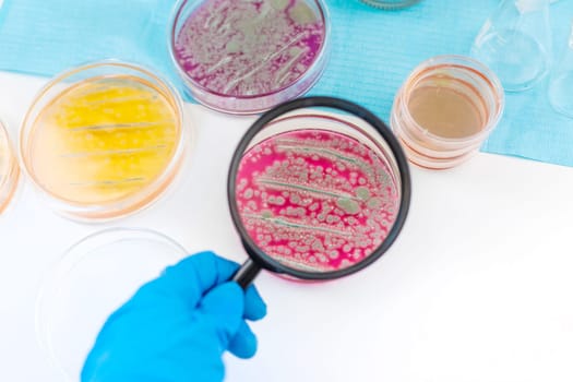 Examine bacteria in petri dishes in the laboratory. Selective focus. nature.