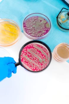 Examine bacteria in petri dishes in the laboratory. Selective focus. nature.
