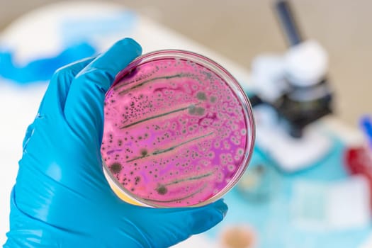 Examine bacteria in petri dishes in the laboratory. Selective focus. nature.